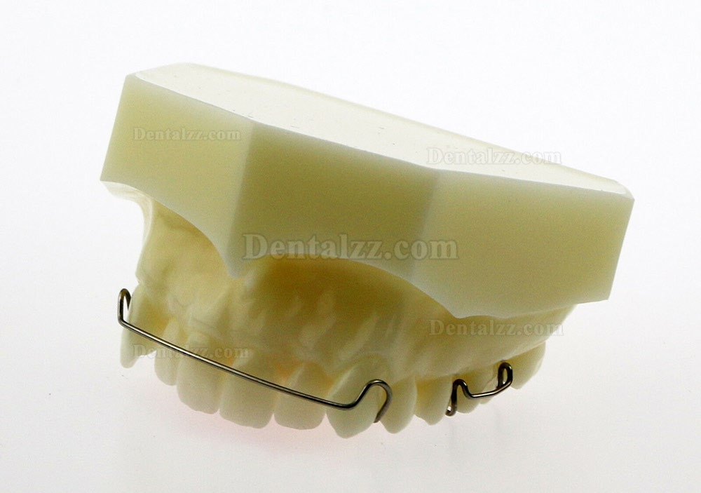 歯科模型 モデル ホーレー リテーナー模型 Hawleyリテーナーモデル #3007 01